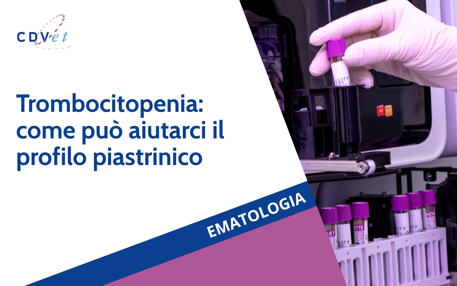 copertina articolo Trombocitopenia: come può aiutarci il profilo piastrinico